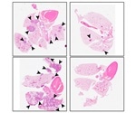 Novel therapeutic approach forces cancer cells to dormancy, prevents metastasis