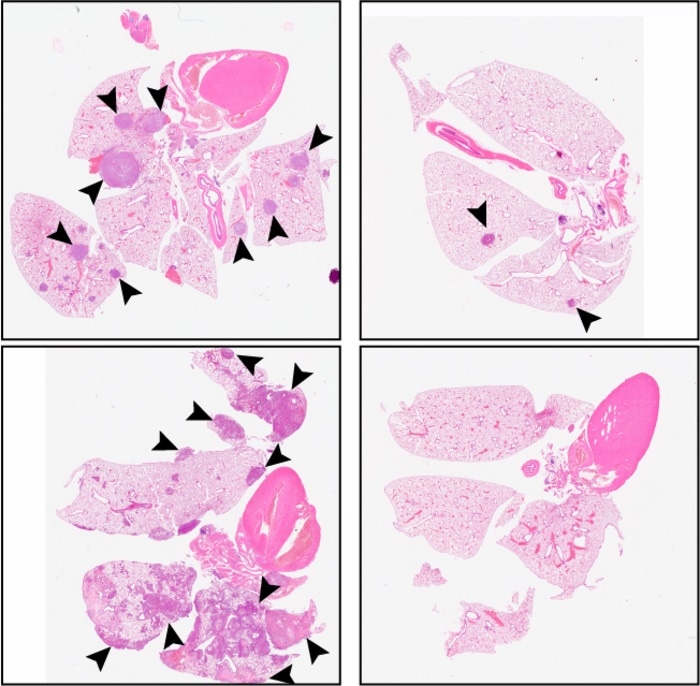 Novel therapeutic approach forces cancer cells to dormancy, prevents metastasis