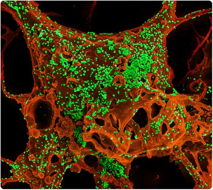 Study identifies a compound capable of easing symptoms of coronavirus infections