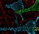 Mysterious protein clusters found on neurons are calcium-signaling “hotspots”, study reveals