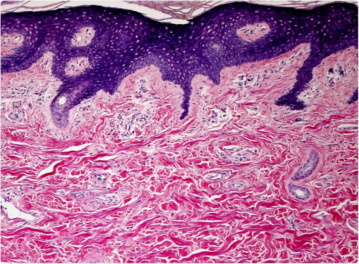 AMSBIO
