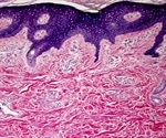 AMSBIO's fully characterized and annotated FFPE tissue blocks can help streamline research projects