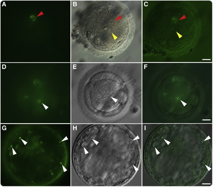 Successful fertilization of rhesus oocytes by in vitro-derived round spermatid-like cells from nonhuman primate embryonic stem cell Successful fertilization of rhesus oocytes by in vitro-derived round spermatid-like cells from nonhuman primate embryonic stem cell
