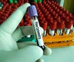 Insight into Immunophenotyping