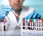 Study discusses outcomes of disclosing actionable genetic results to research participants