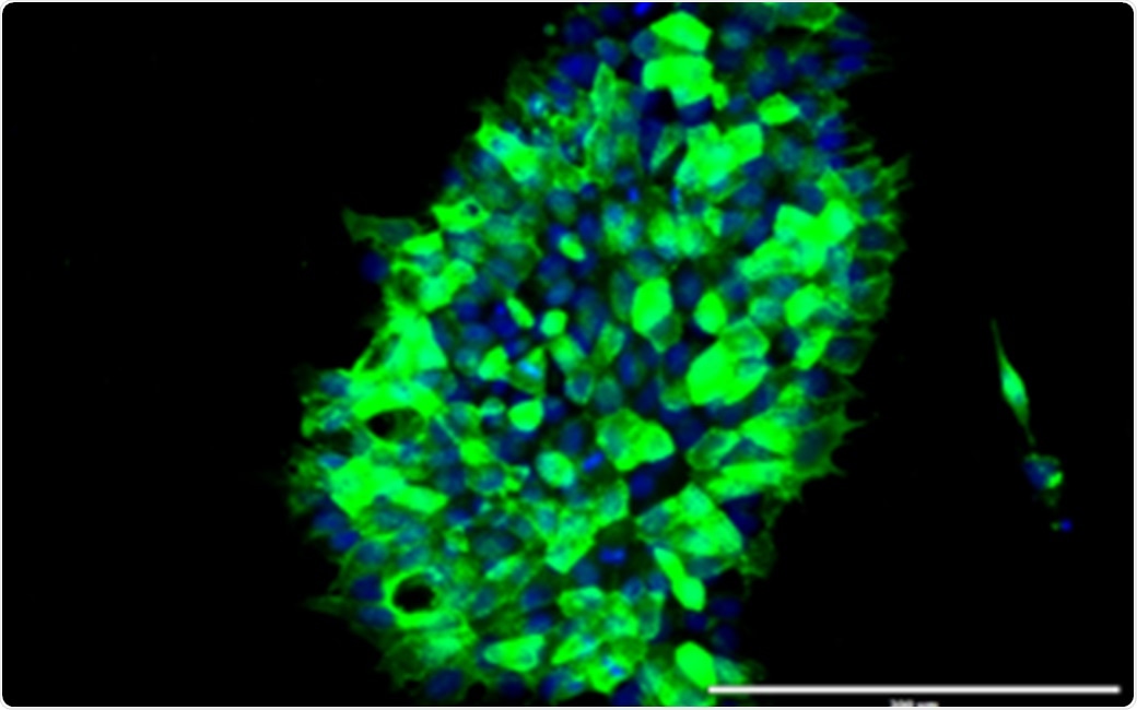 Novel technique precisely corrects DNA errors in cultured patient cells