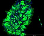 Novel technique precisely corrects DNA errors in cultured patient cells