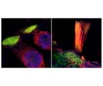 Experts visualize genes linked to hearing loss in humans