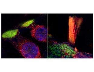 Experts visualize genes linked to hearing loss in humans