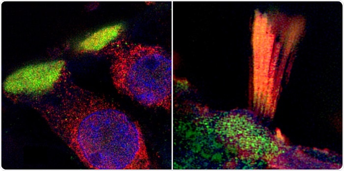Experts visualize genes linked to hearing loss in humans