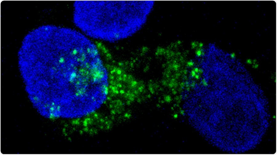Study uncovers mechanism that triggers cancer cell death
