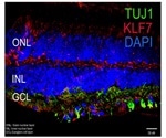 Experts create world’s first single-cell atlas of human and porcine eyes