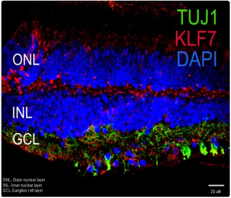 Experts create world’s first single-cell atlas of human and porcine eyes