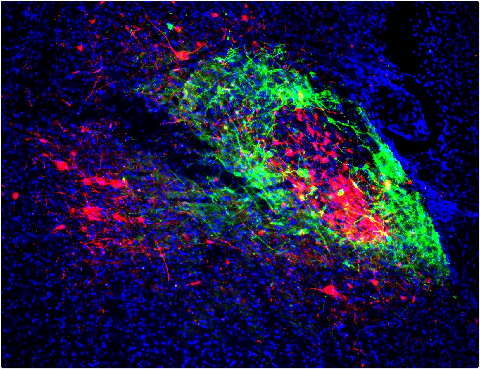Neural circuit coordinates breathing with negative emotions, says study