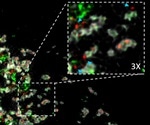 Study identifies novel function for existing protein