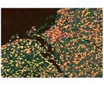 Researchers identify protein that promotes wound healing and repair