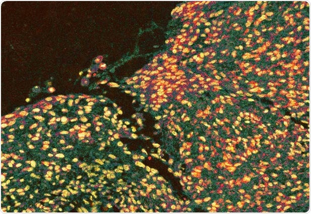 Researchers identify protein that promotes wound healing and repair