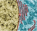 Study uncovers mechanisms behind rupture and repair of the nuclear envelope