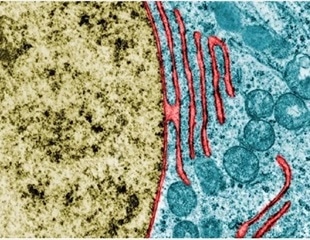 Study uncovers mechanisms behind rupture and repair of the nuclear envelope