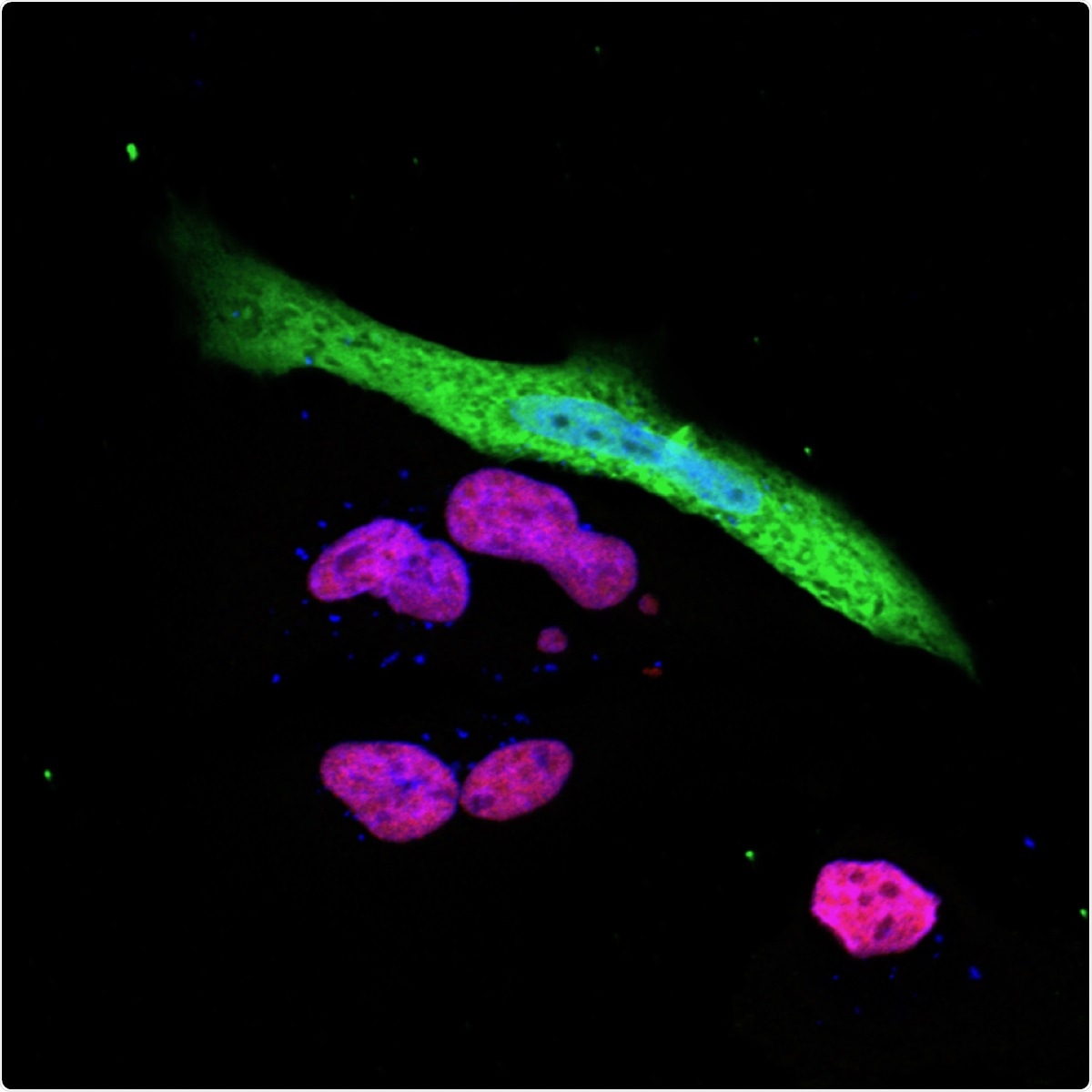 Study uncovers an immune evasion mechanism of SARS-CoV-2