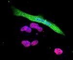 Study uncovers an immune evasion mechanism of SARS-CoV-2