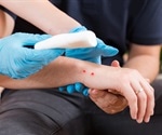 Improving the Treatment of Snakebite