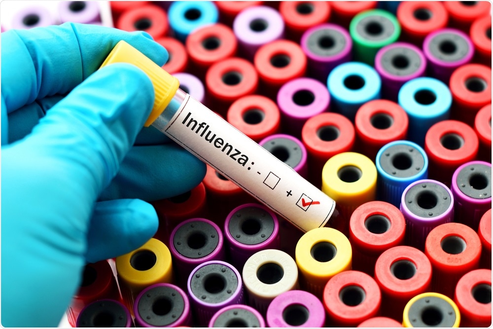 Influenza Influenza