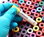 Study analyzes response of individuals from diverse populations to infections