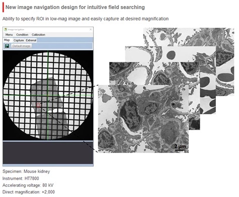 The HT7800: A Versatile Transmission Electron Microscope