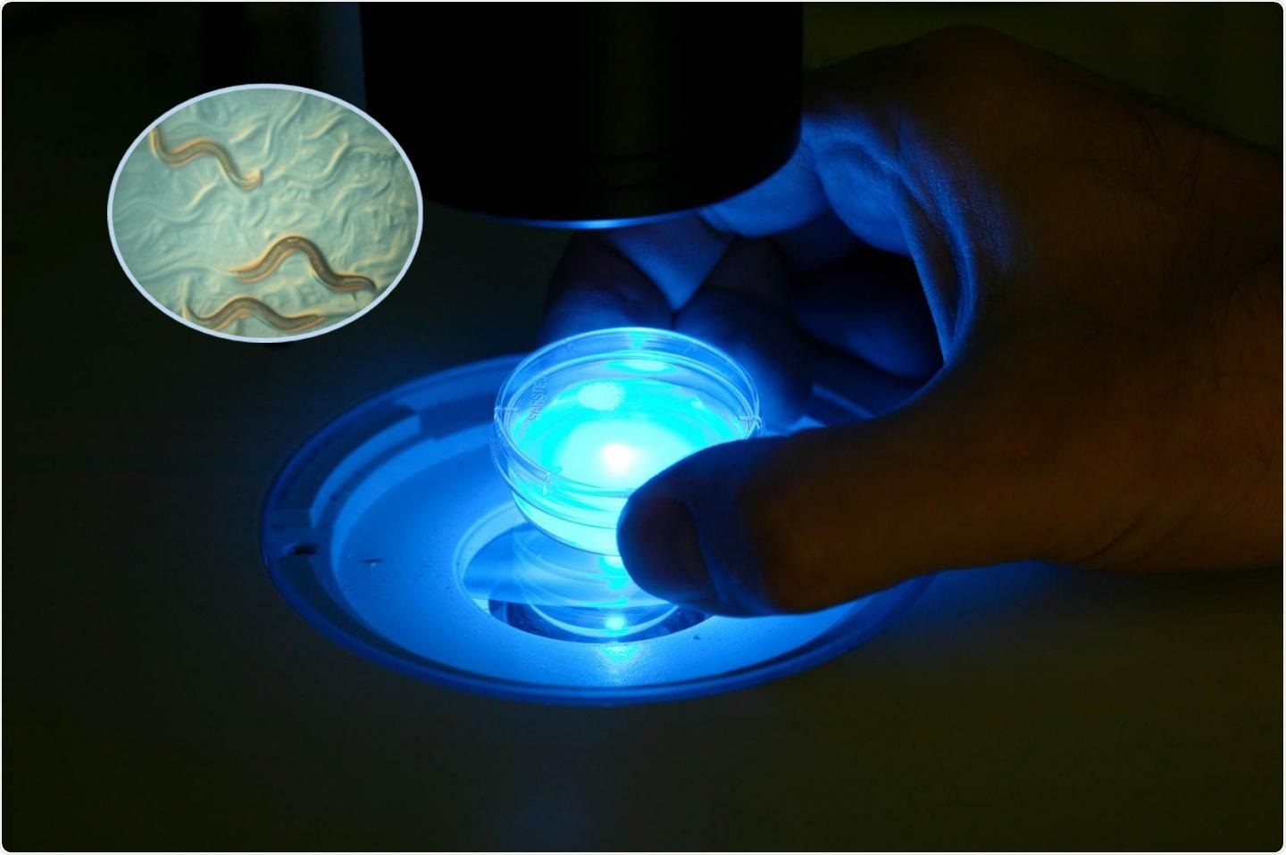 Study reveals new functions of ENDOU enzymes