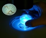 Study reveals new functions of ENDOU enzymes