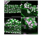 Researchers identify tumor suppressor gene involved in stress response