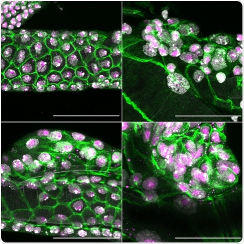 Researchers identify tumor suppressor gene involved in stress response