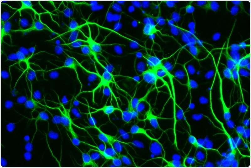 Longevity gene contributes to brain health during aging