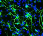 Longevity gene contributes to brain health during aging