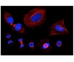 Molecular mapping of proteins shows promise for treating cancer