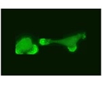 New statistical study shows how pairs of cancer cells interact