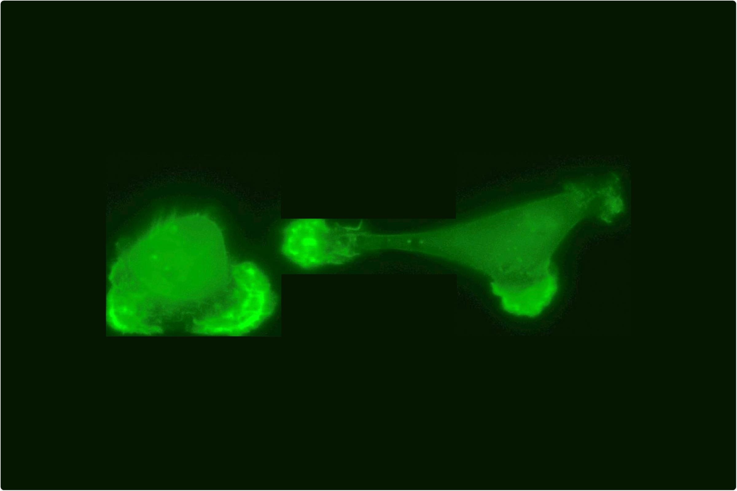 New statistical study shows how pairs of cancer cells interact