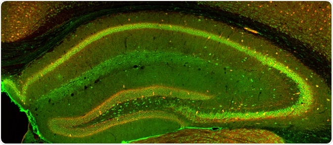 Confocal Imaging Confocal Imaging