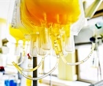 A Beginners Guide to Plasma Proteomics