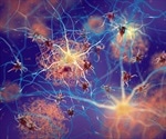 Two new Alzheimer’s genes discovered