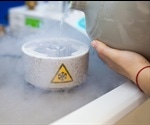 Electron cryo-microscopy sheds light on how bioenergy makers are made in our body