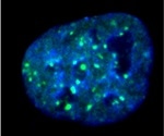 Specific enzyme can delay the growth and spread of neck and head carcinomas