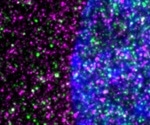 Mutant protein plays key role in Huntington’s disease