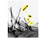Study into cellular filopodia could optimize cancer therapy and wound closure