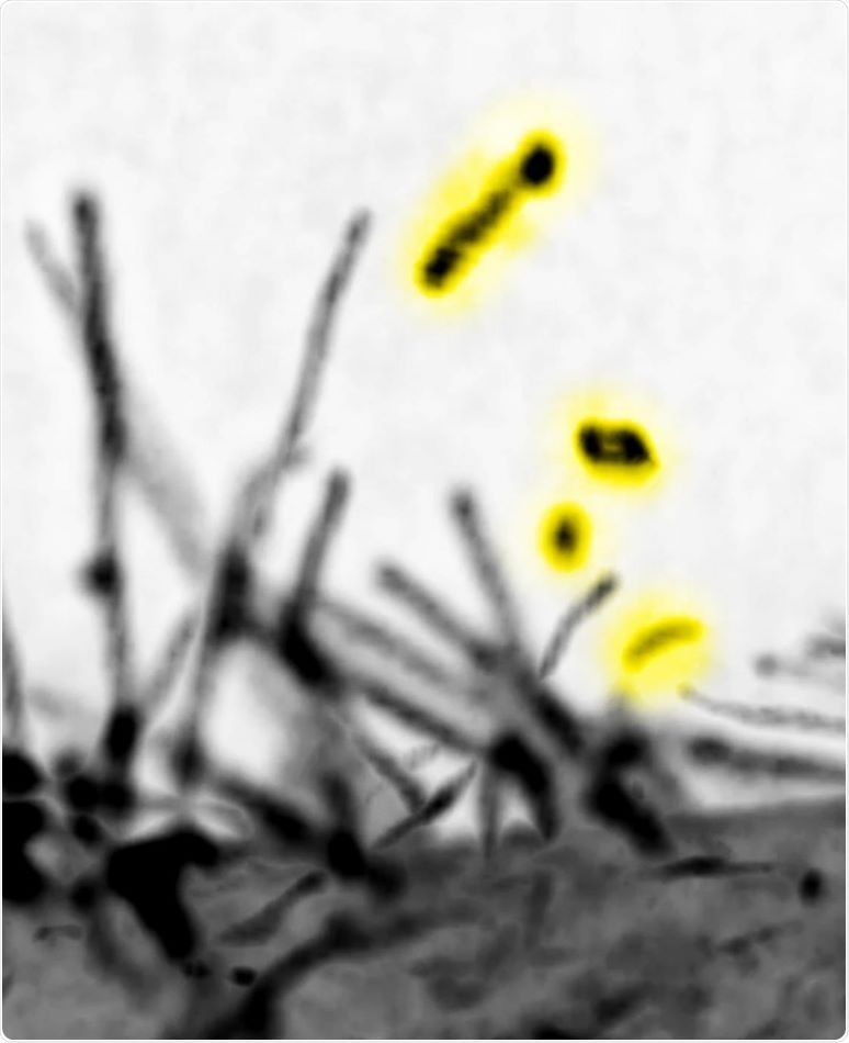 Study into cellular filopodia could optimize cancer therapy and wound closure