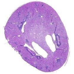 Non-circulating memory T cells contribute to chronic transplant rejection