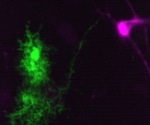 Synthetic cannabinoid reduces essential tremors by activating astrocytes