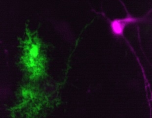Synthetic cannabinoid reduces essential tremors by activating astrocytes