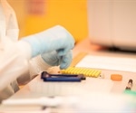 Disease-driving B cells play a role in non-alcoholic fatty liver disease